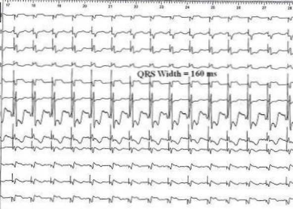 Figure 1B