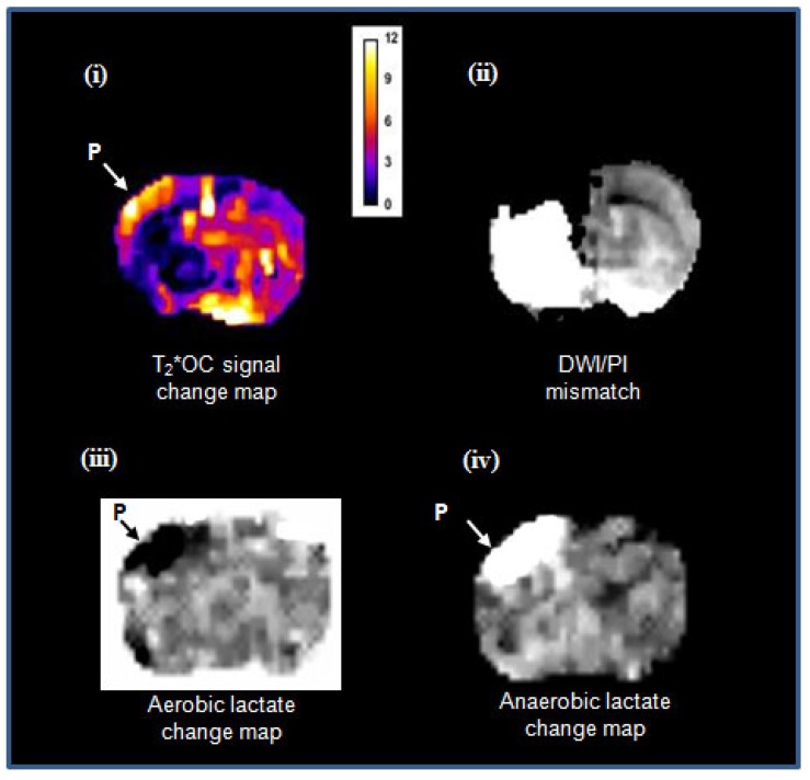 Figure 12