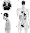 Fig. 1