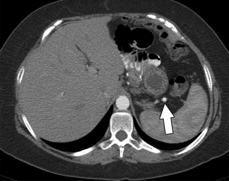FIG 4A