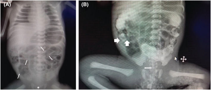 FIGURE 1