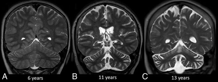 FIG 3.