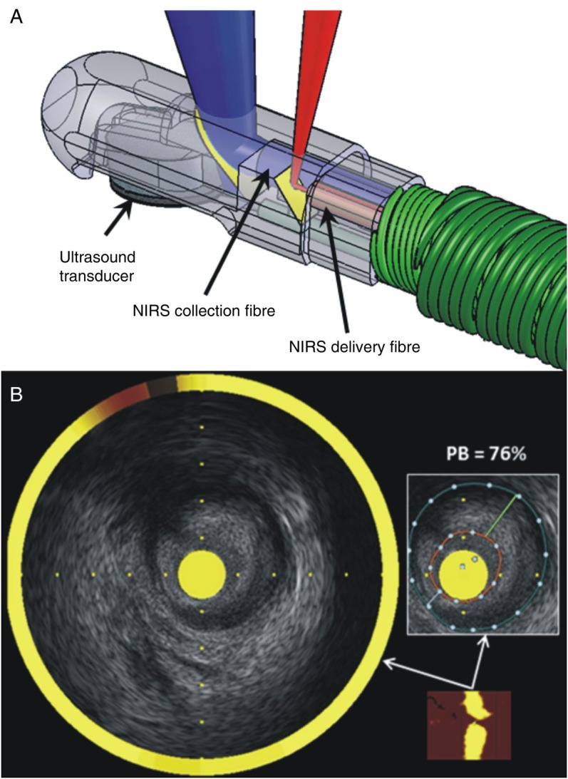 Figure 2