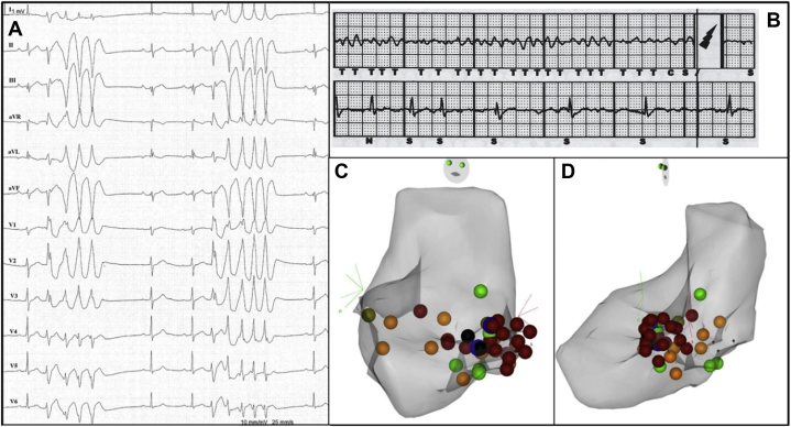 Figure 1