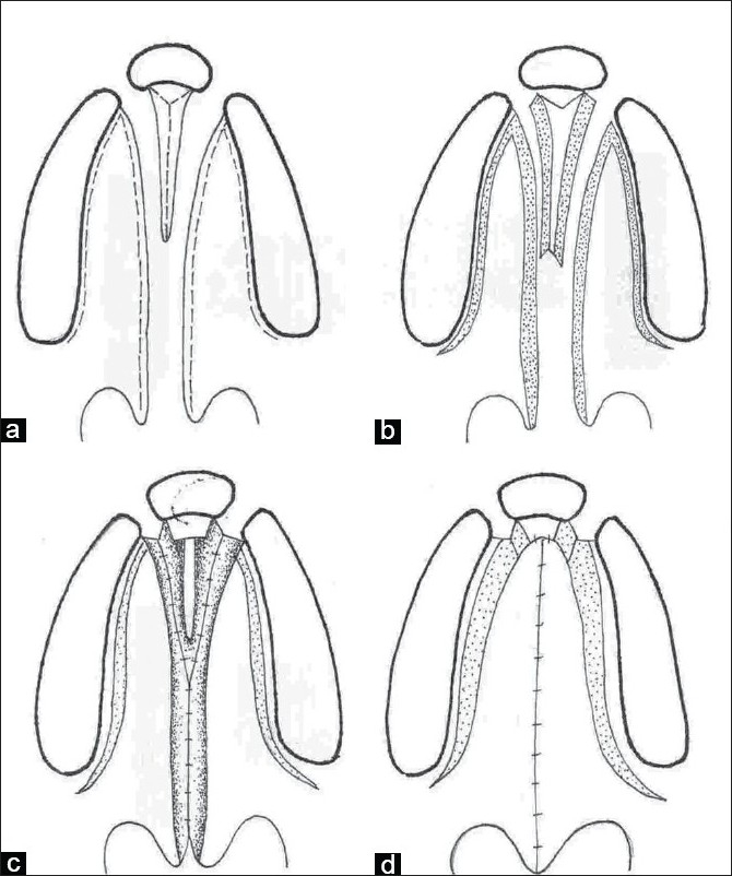 Figure 3a-d