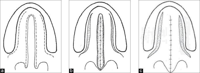 Figure 1a-c