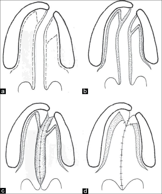 Figure 2a-d