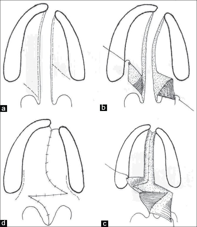 Figure 4a-d