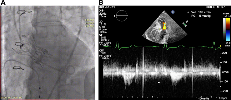 Figure 6