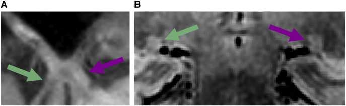 Fig. 7