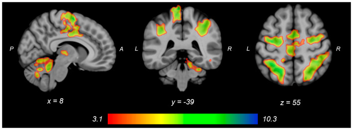 Figure 2