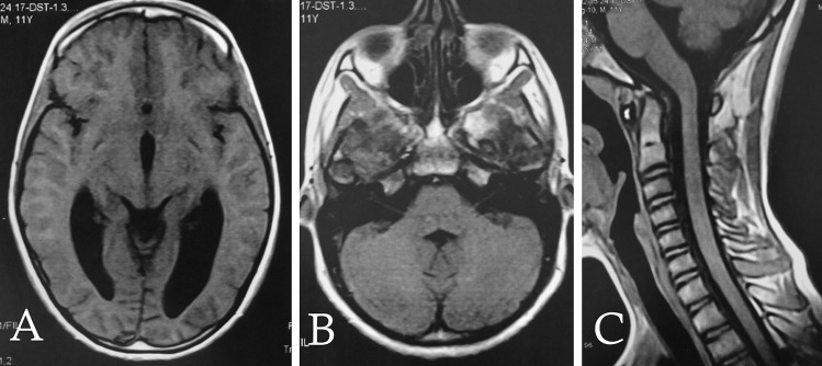 Fig. 2