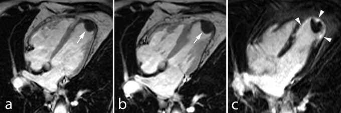 Fig. 10