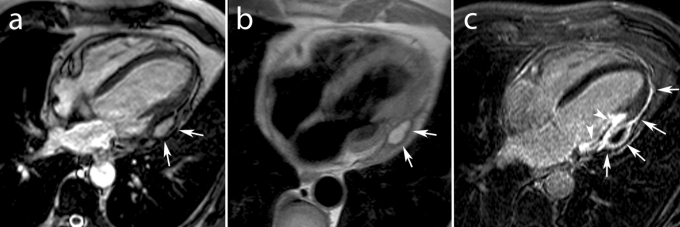 Fig. 11