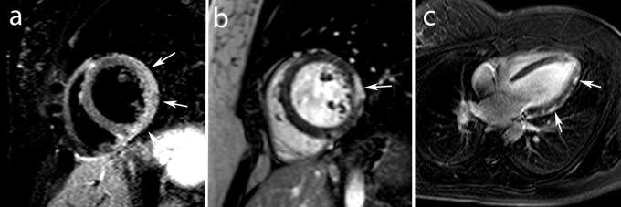 Fig. 7