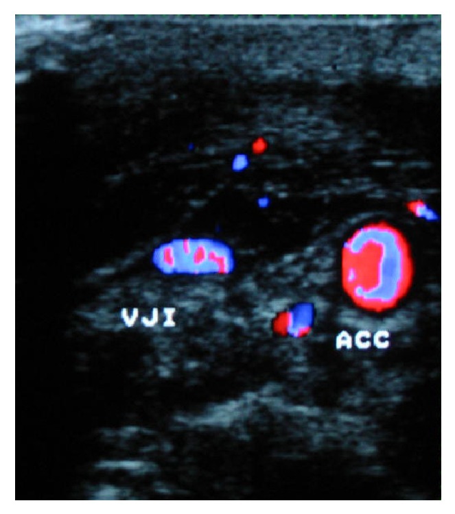 Figure 2