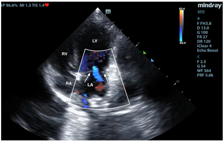 Figure 4