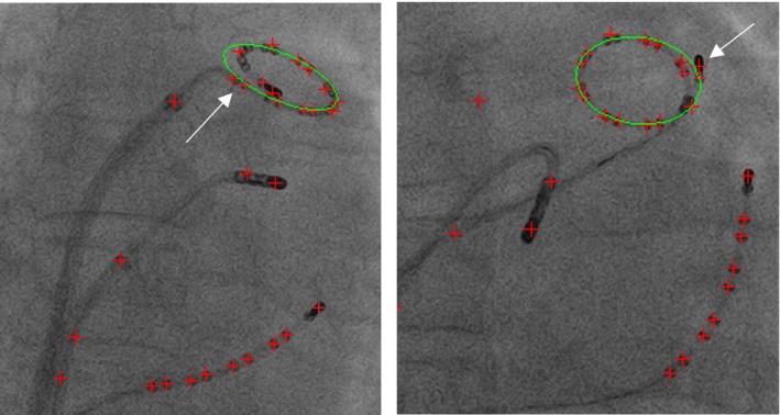 Figure 13