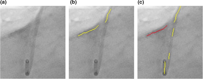 Figure 16