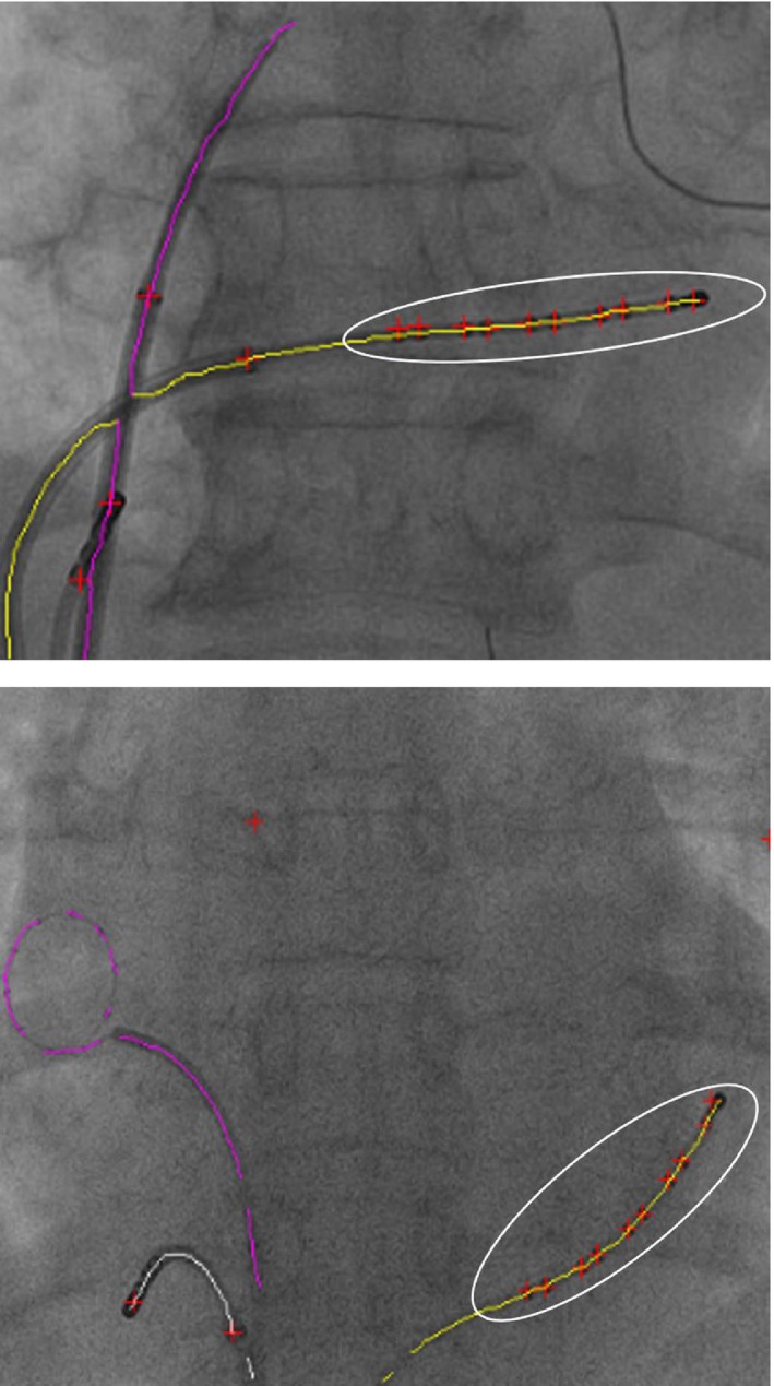 Figure 14