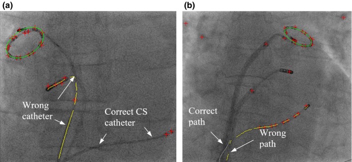 Figure 15