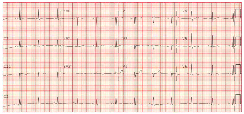 Figure 1: