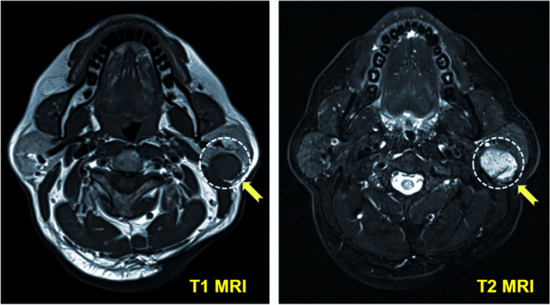 Fig. 10