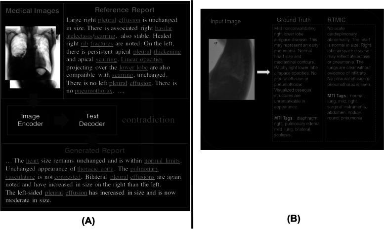 Fig. 14