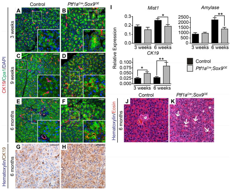 Identification of Sox9-dependent acinar-to-ductal reprogramming as the ...