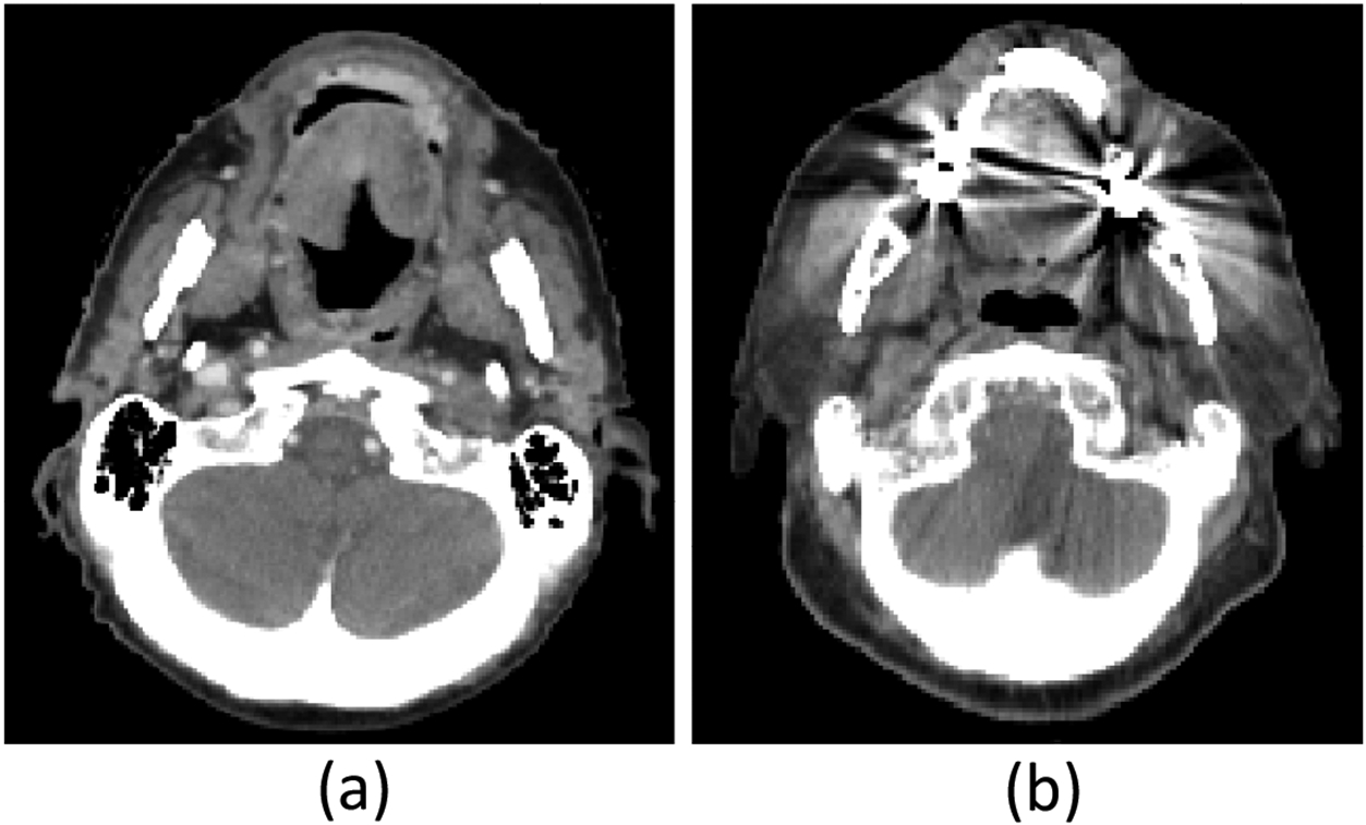 Figure 1: