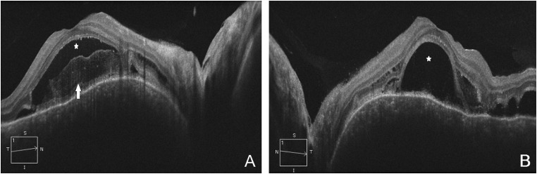 Figure 3