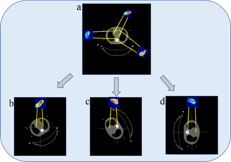 Fig. 2