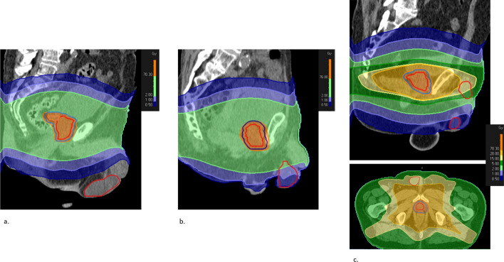 Fig. 2