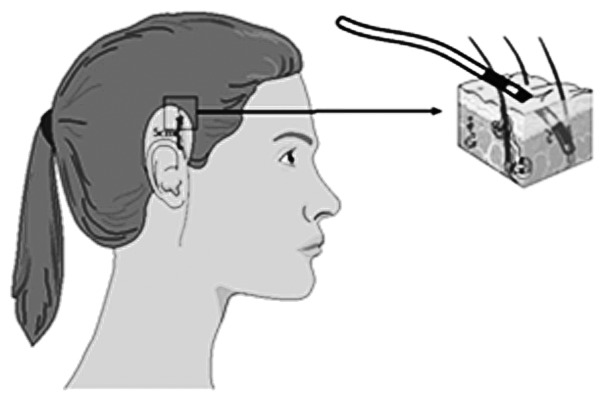 Figure 2.