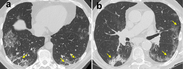 Fig. 10