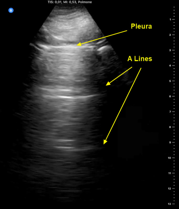 Fig. 1