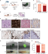 Figure 2. A TEAZ platform to screen for metastasis modulators in vivo. A, Generation of a baseline BRAFV600E tp53−/− pten−/− metastatic melanoma model using TEAZ. MAZERATI 2X (MAS2X) sgpten plasmid was co-electroporated with a mitfa:GFP plasmid to generate loss of pten in a melanocyte-specific manner. B, Representative fluorescent image of an adult zebrafish with a BRAFV600E tp53−/−pten−/− tumor 16 weeks after TEAZ. C, Quantification of tumor incidence in animals expressing an NT sgRNA or pten sgRNAs represented as percent of fish with tumors. Fisher two-sided t test was performed on data from n = 3 independent experiments. ***, P = 0.003. D, Sagittal sectioning of animals with melanomas for IHC. E, Histology of BRAFV600E tp53−/− pten−/− melanomas demonstrating tumor cell expression of GFP, BRAFV600E, and activated AKT signaling. Scale bar, 60 μm. F, IHC staining for GFP in muscle (left images) and kidney marrow (right images) of animals bearing BRAFV600E tp53−/− pten−/− showing the presence of invading tumor cells (scale bar, 100 μm) and distal metastasis (scale bar, 60 μm), respectively. Arrows indicate metastatic tumor cells. G, Representative images of animals with NT or alb KO melanomas at 6 weeks after TEAZ (top, fluorescent GFP imaging at 25×) and 12 weeks after TEAZ (bottom, brightfield image at 3.5×). Tumor is indicated by a black arrow in each group. Scale bar on the graph. H, Quantification of the presence of melanin in animals expressing a NT sgRNA or alb sgRNAs represented as percent of fish with melanin. Fisher two-sided t test was performed on data from n = 3 independent experiments. *, P < 0.05.