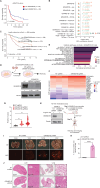 Figure 4. GRAMD1B is a metastasis suppressor in human melanoma. A, Kaplan–Meier survival plots comparing overall survival (OS) probabilities (Y-axis) as a function of time in years (X-axis) in patients with low (n = 95) and high (n = 93) GRAMD1B expression based on median GRAMD1B expression split in the AVAST-M melanoma cohort. A log-rank test comparing the survival distributions of both groups is indicated with a P value. B, Forest plot indicating the hazard ratio (HR) estimates related to GRAMD1B expression when predicting OS (green) and progression-free survival (PFS, orange) by means of Cox proportional hazard models controlling for different clinical variables (Y-axis) in the AVAST-M melanoma cohort (n = 194). The HR estimates are indicated by the dots at the center of the error bars; the horizontal error bars correspond to the 95% confidence intervals of the HR. The two-sided Wald t test P values corresponding to GRAMD1B expression are indicated for each model and outcome. Sex (male or female), age (as a continuous variable), stage (IIB, IIC, IIIA, IIIB, or IIIC), ECOG; Eastern Cooperative Oncology Group Performance Status (0 or 1), treatment (bevacizumab or placebo), NClass (N0, N1, N2, or N3), NRAS mutation (mutant or wild-type); TIL count, tumor-infiltrating lymphocyte count (brisk, nonbrisk or absent). C, Kaplan–Meier plot for melanoma-specific survival in patients with low and high GRAMD1B expression (split on median) and Breslow thickness (split at 3 mm). There is a significant interaction (P = 0.005) between the two factors in Cox proportional hazards risk regression. The difference between the two bottom curves has a hazards ratio of 0.56 (95% CI, 0.38–0.83). D, Generation of SKMEL2 cells expressing NT sgRNA and GRAMD1B sgRNA for bulk RNA-seq. RNA-seq was performed on n = 3 biological replicates per experimental group (top). Bottom, Western blot analysis of GRAMD1B in SKMEL2 cells expressing an NT sgRNA or 2 independent sgRNAs against GRAMD1B. Tubulin served as a loading control in this and all subsequent western blots. Quantification of GRAMD1B normalized to Tubulin and relative to NT sgRNA are in black text below the blot. E, Bar graph depicting top Hallmark pathways enriched in GRAMD1B KO cells plotted against the normalized enrichment score. An FDR cutoff of 0.1 was used for multiple hypothesis testing, and pathways are ranked by nominal P value. F, Heat map depicting differential upregulation of EMT genes in GRAMD1B KO cells. Log2 normalized counts of genes involved in the EMT pathway (FDR q = 0.028) are rescaled and plotted for NT and GRAMD1B sgRNA samples, n = 3 biological replicates per group. G, Quantification of invasiveness of GRAMD1B KO SKMEL2 cells relative to NT cells. Data represent fold change in invasion and pooled from n = 3 independent experiments. Invasiveness was calculated by normalizing Calcein fluorescence to the NT group. See Methods for details. Error bars, SD; a two-tailed t test was used to assess statistical significance. **, P = 0.001 for GRAMD1B sgRNA1 vs. NT; **, P = 0.002 for GRAMD1B sgRNA2 vs. NT. H, Schematic for generation of doxycycline-inducible shRNA cells for the tail-vein metastasis assay in mice. Left, western blot analysis of GRAMD1B in SKMEL2 cells expressing an NT shRNA or GRAMD1B shRNA and treated with doxycycline for 4 days. Right, schematic of tail-vein metastasis assay using these shRNA cells. I, Brightfield and fluorescent (RFP) images of lung and liver tissues imaged at 6 × 3 weeks after tail-vein injection of NT or GRAMD1B shRNA SKMEL2 cells. White arrows represent metastatic tumor cells. J, Histology of mouse lung and liver tissues from mice injected with NT or GRAMD1B shRNA SKMEL2 cells. Scale bars, 5 mm or 0.2 mm. K, Quantification of metastatic burden in livers of mice injected with NT or GRAMD1B shRNA SKMEL2 cells, represented as % tumor-positive liver area. n = 2 animals per group, with 4–5 ROI per liver lobe. Error bars, SD; a Welch t test was used to assess statistical significance.