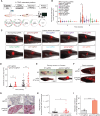 Figure 3. An in vivo screen identifies GRAMD1B as a metastasis suppressor in melanoma. A, Strategy for in vivo metastasis screen. Zebrafish orthologs for candidate genes were obtained and MITF GFP 2X sgRNA pools expressing 4 sgRNAs per candidate were co-electroporated with the multiplasmid mix to induce metastatic melanoma. Candidates from the primary screen were assessed for their ability to modulate metastasis via fluorescent imaging of areas separate from the primary tumor. See Methods for details. B, Quantification of tdTomato+ primary tumor area in animals expressing NT sgRNA or sgRNA pools against candidates at 4 and 8 weeks after TEAZ. Data were obtained from n = 3 independent experiments, and all data points were normalized to NT sgRNA tumors at week 4. Error bars, SD; Mann–Whitney test was used to compare ranks between tumor area of candidates vs. NT sgRNA at each time point. *P = 0.013. C, Representative images showing tdTomato+ melanomas from animals expressing a NT sgRNA or candidate sgRNAs at 8 weeks after TEAZ. Scale bar, 1 mm. D, Quantification of tdTomato+ primary tumor area in a validation cohort of animals expressing NT sgRNA or gramd1b sgRNAs at 4 and 8 weeks after TEAZ. Data are pooled from n = 4 independent experiments. Error bars, SD, Mann–Whitney test was used to compare ranks between tumor areas of gramd1b sgRNA vs. NT sgRNA at each time point to obtain; **, P = 0.001 at 4 weeks; **P = 0.007 at 8 weeks. E, Representative brightfield and fluorescent images for tdTomato showing animals bearing tumors expressing NT sgRNA or gramd1b sgRNAs at 12 weeks after TEAZ. Scale bar, 5 mm. F, Representative fluorescent image of tdTomato+ distal metastasis (white arrows indicate metastatic cells) in the kidney marrow of animals expressing NT or gramd1b sgRNAs. Scale bar, 2 mm. G, IHC validation of tdTomato+ metastatic tumor cells (black arrows) in kidney marrow of an animal expressing gramd1b sgRNAs. Scale bars indicated on image. H, Quantification of metastatic burden in animals expressing NT or gramd1b sgRNAs represented as corrected total cell fluorescence (integrated density, sum of values of tdTomato pixels in image) at 12 weeks after TEAZ. Data are pooled from n = 4 independent experiments. Error bars, SD; a Welch t test was used to test statistical significance. *, P = 0.0122. I, Quantification of metastatic incidence in animals with NT or gramd1b KO melanomas expressed as % of fish with metastasis at 12 weeks after TEAZ. Data are pooled from n = 4 independent experiments. Error bars, SD, Welch t test was used to assess statistical significance. ***, P = 0.0005.