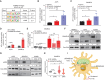 Figure 7. Sterol overload activates AP-1 via ERK signaling to mediate invasion upon GRAMD1B loss in melanoma. A, HOMER analysis of top motifs enriched in genes upregulated in GRAMD1B KO cells. Motifs related to the AP-1 complex are highlighted in the table along with rank and P value. Dual reporter analysis of AP-1 luciferase reporter activity in A375 cells treated with 25 μmol/L cholesterol or 10 μmol/L 27-HC for 48 hours. Firefly AP-1 luciferase activity was normalized to Renilla luciferase and relative luciferase activity is plot normalized to vehicle. Data are pooled from n = 3 independent experiments. Error bars, SD; a Welch t test was performed to assess statistical significance. *, P = 0.01; **, P = 0.001. C, Dual reporter analysis of AP-1 luciferase reporter activity in SKMEL2 cells treated with 25 μmol/L cholesterol or 25 μmol/L 27-HC for 48 hours. Firefly AP-1 luciferase activity was normalized to Renilla luciferase and relative luciferase activity is plot normalized to vehicle. Data are pooled from n = 3 independent experiments. Error bars, SD; a Welch t test was performed to assess statistical significance. *P = 0.04,**P = 0.002. D, Dual reporter analysis of AP-1 luciferase reporter activity in A375 and SKMEL2 NT or GRAMD1B knockdown cells. Firefly AP-1 luciferase activity was normalized to Renilla luciferase and relative luciferase activity is plot normalized to NT shRNA. Data are pooled from n = 3 independent experiments. Error bars, SD, a Welch t test was performed to assess statistical significance. ***, P = 0.0003; ****, P = 0.000038. E, Dual reporter analysis of AP-1 luciferase reporter activity in SKMEL2 NT or GRAMD1B knockdown cells treated with DMSO (vehicle), 200 nmol/L JNKi or 200 nmol/L ERKi for 48 hours. Firefly AP-1 luciferase activity was normalized to Renilla luciferase and relative luciferase activity is plot normalized to NT shRNA (vehicle). Data are pooled from n = 3 independent experiments. Error bars, SD, a Welch t test was performed to assess statistical significance. *, P = 0.01; ****, P <0.000001. F, Western blots depicting phosphorylation of ERK1/2 in SKMEL2, A375, and A2058 cells expressing NT or GRAMD1B sgRNAs. Data are representative of n = 2–3 independent experiments. Quantification of phosphorylated ERK protein levels relative to total ERK in black text below the blot. G, Western blots depicting phosphorylation of ERK1/2 in A375, SKMEL2, and A2058 cells stimulated with cholesterol or 27-HC for 48 hours. Data are representative of n = 2 independent experiments. Quantification of phosphorylated ERK protein levels relative to total ERK in black text below the blot. H, Quantification of relative invasion in SKMEL2 cells expressing NT or GRAMD1B shRNA treated with 100 nmol/L ERKi for 24 hours. The number of Hoechst+ cells in the bottom chamber in each group was normalized to the NT group to obtain relative invasion. See Methods for details. Data are pooled from n = 3 independent experiments. Error bars, SD, a Welch t test was performed. *, P < 0.05; ****, P < 0.0001. I, Working model of prometastatic functions of GRAMD1B loss in melanoma. GRAMD1B loss results in free cholesterol, some of which may move into the mitochondria, where it is converted to 27-HC. Free sterols induce ERK signaling to activate the AP-1 complex and mediate an invasion transcriptional program in melanoma to promote metastasis.