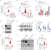 Figure 6. Free cholesterol and 27-hydroxycholesterol promote tumor invasion under GRAMD1B loss. A, Quantification of relative cholesterol levels (represented as fold change and normalized to NT cells) in SKMEL2 NT and GRAMD1B shRNA cells cultured in control media or cholesterol-depleted media. To deplete cholesterol, cells were grown in media containing 10% Lipoprotein-free FBS and Simvastatin for 48 hours. See Methods for details. Data are pooled from n = 3 independent experiments; error bars, SD; a Welch t test was used to assess statistical significance. *, P = 0.018; ***, P = 0.0005; ****, P < 0.0001. B, Quantification of relative invasion in cells from A. The number of fluorescent cells in the bottom chamber was quantified and normalized to the NT group to obtain relative invasion. Data are pooled from n = 3 independent experiments; error bars, SD; a Welch t test was used to assess statistical significance. ***, P = 0.0001; ****, P < 0.0001. C, Quantification of relative invasion (represented as fold change and normalized to vehicle) in A375 and SKMEL2 cells treated with cholesterol (25 μmol/L) or 27-hydroxycholesterol (27-HC, 10 μmol/L) for 48 hours. The number of fluorescent cells in the bottom chamber was quantified and normalized to the vehicle group to obtain relative invasion. Data are pooled from n = 3 independent experiments; error bars, SD; a Welch t test was used to assess statistical significance. *, P < 0.05. D, Western blot analysis of CYP27A1 and GRAMD1B in SKMEL2 NT and GRAMD1B KO cells. CYP27A1 levels normalized to Tubulin are in black text below the blot. E, Western blot analysis of CYP27A1 in A2058, A375, and SKMEL2 cells transfected with control siRNA or CYP27A1 siRNA. CYP27A1 levels normalized to Tubulin are in black text below the blot. F, Relative invasion of A2058, A375, and SKMEL2 cells transfected with control siRNA or CYP27A1 siRNA. The number of fluorescent cells in the bottom chamber was quantified and normalized to control cells to obtain relative invasion. Data are pooled from n = 3 independent experiments; error bars, SD; a Welch t test was used to assess statistical significance. *, P < 0.05; ****, P < 0.0001. G, Real-time PCR analysis of CYP27A1 in SKMEL2 NT and GRAMD1B KO cells transfected with control siRNA or CYP27A1 siRNA. Data are pooled from n = 3 independent experiments; error bars, SD; a Welch t test was used to assess statistical significance. ****, P < 0.0001. H, Western blot analysis of CYP27A1 and GRAMD1B in SKMEL2 NT and GRAMD1B KO cells transfected with control siRNA or CYP27A1 siRNA. I, Relative invasion of SKMEL2 NT and GRAMD1B KO cells transfected with control siRNA or CYP27A1 siRNA. Data are pooled from n = 3 independent experiments; error bars, SD; a Welch t test was used to assess statistical significance. ****, P < 0.0001; **, P < 0.01.