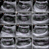 Fig. 3.