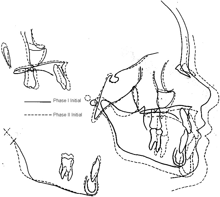 Figure 16