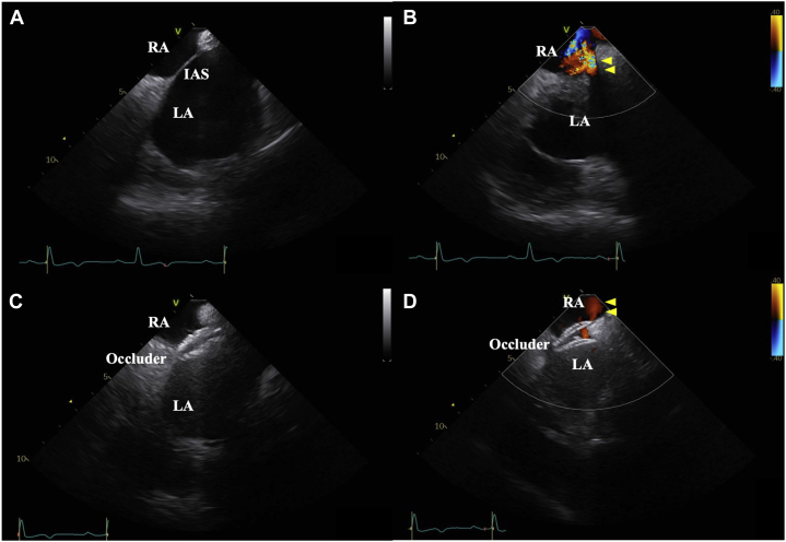 Figure 5