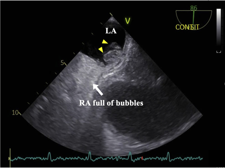 Figure 4