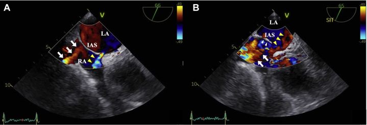 Figure 3