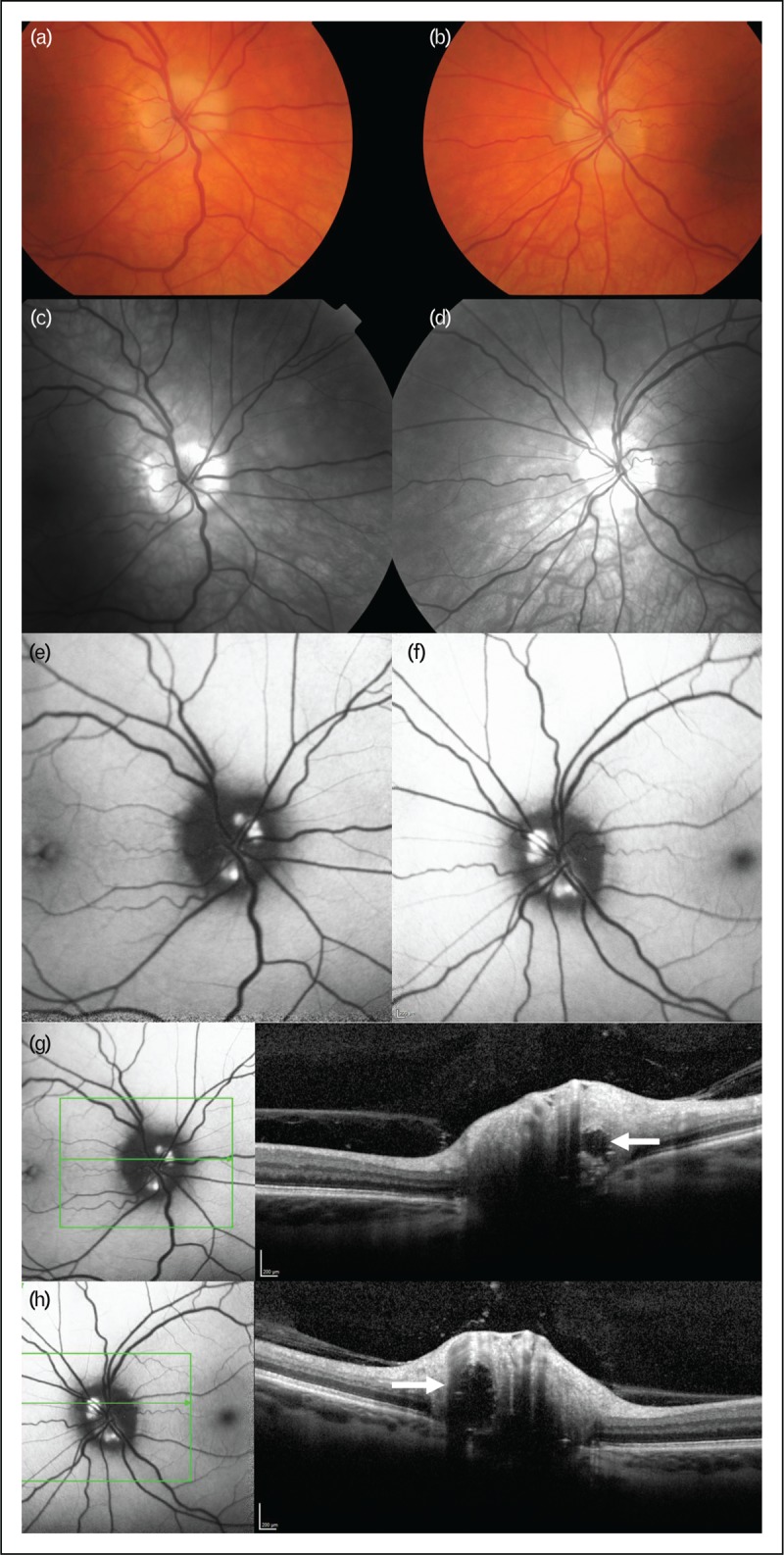 FIGURE 1