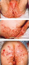 Figure 1 A-C