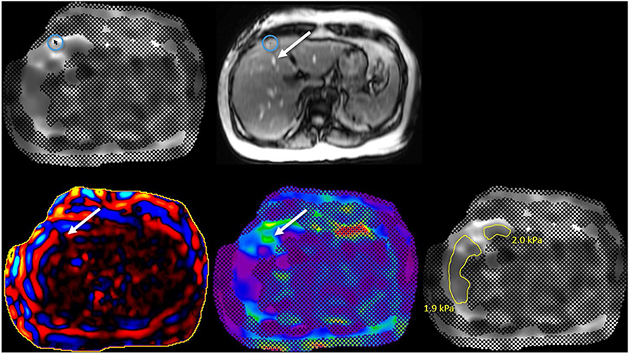 Fig. 13