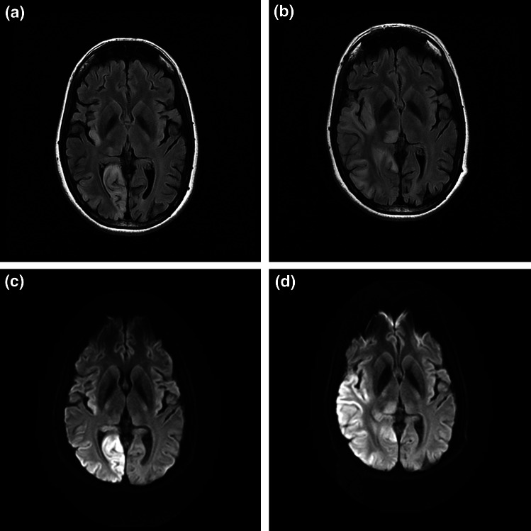 Fig. 1